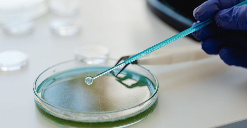 Top Non-Ionic Surfactants for Textile Processing